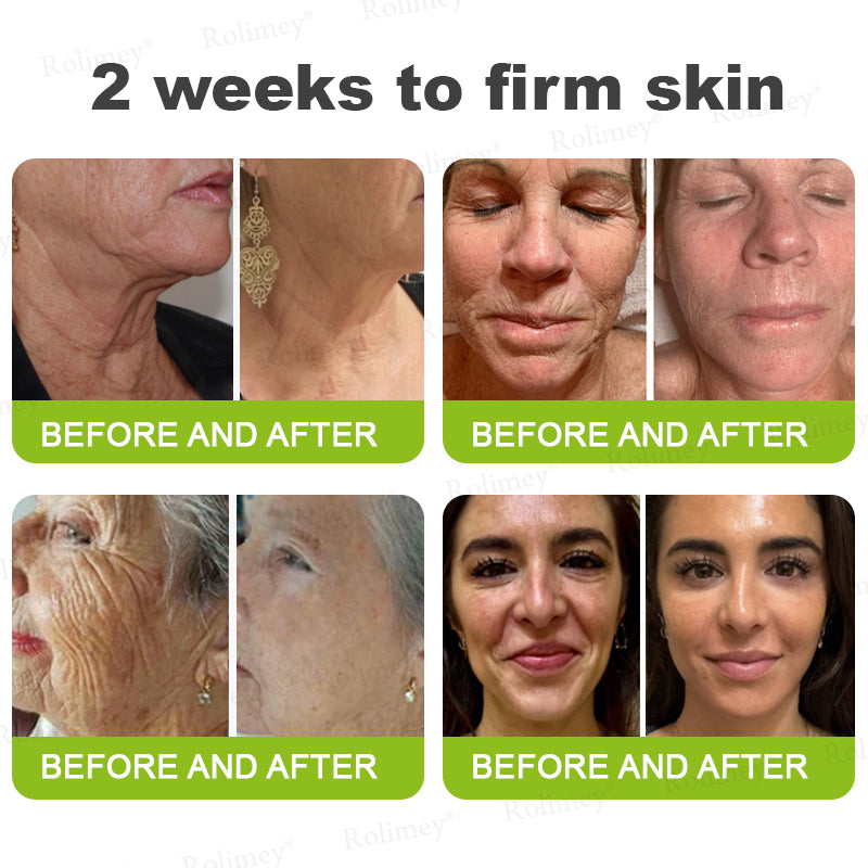 👏💧✨Made and shipped from the USA 💫Botox & Vita-A Retinol Shot Wrinkle-Lift Tightening cream - Last Day Promotion 50% OFF