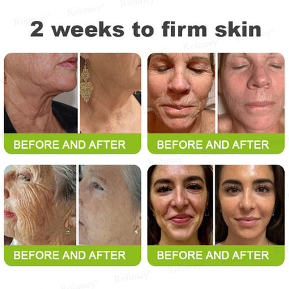 👏💧✨Made and shipped from the USA 💫Botox & Vita-A Retinol Shot Wrinkle-Lift Tightening cream - Last Day Promotion 50% OFF