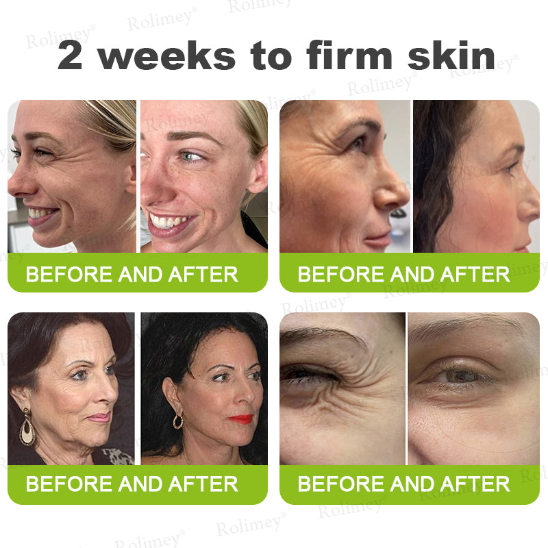 👏💧✨Made and shipped from the USA 💫Botox & Vita-A Retinol Shot Wrinkle-Lift Tightening cream - Last Day Promotion 50% OFF
