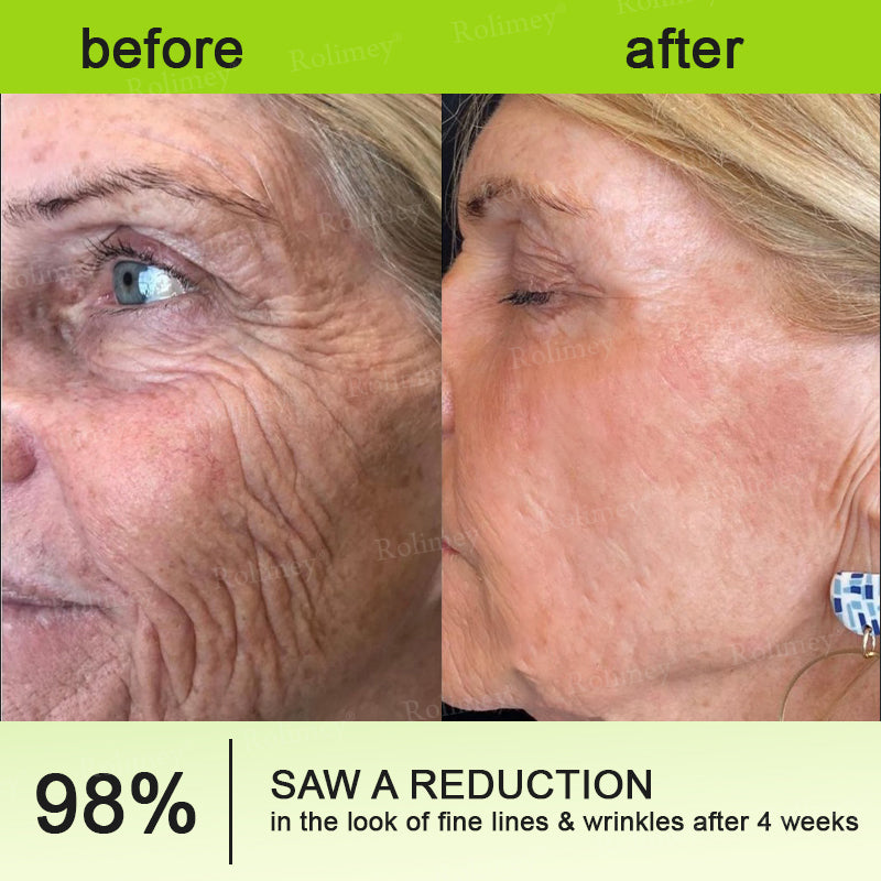 👏💧✨Made and shipped from the USA 💫Botox & Vita-A Retinol Shot Wrinkle-Lift Tightening cream - Last Day Promotion 50% OFF