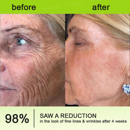 👏💧✨Made and shipped from the USA 💫Botox & Vita-A Retinol Shot Wrinkle-Lift Tightening cream - Last Day Promotion 50% OFF