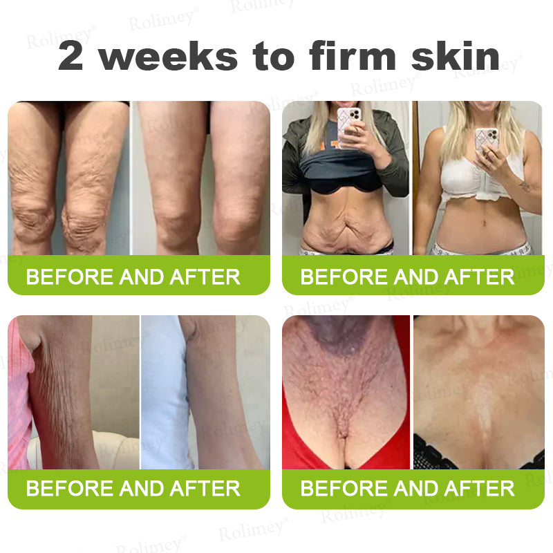 👏💧✨Made and shipped from the USA 💫Botox & Vita-A Retinol Shot Wrinkle-Lift Tightening cream - Last Day Promotion 50% OFF