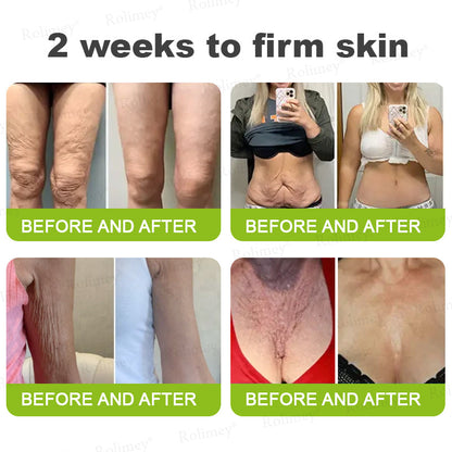 👏💧✨Made and shipped from the USA 💫Botox & Vita-A Retinol Shot Wrinkle-Lift Tightening cream - Last Day Promotion 50% OFF