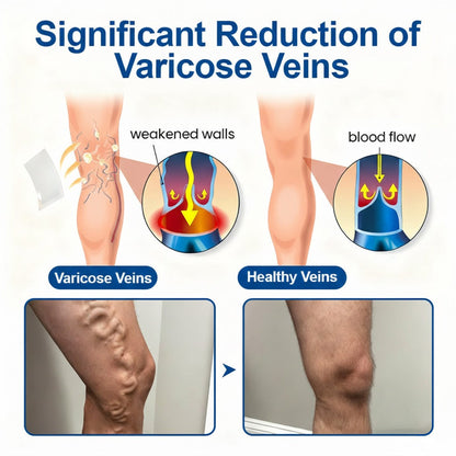 🇺🇸👨‍⚕️✅ JUXEK® Vein Ease Microneedle Patch — Visible Vein Reduction in 7 Days, No Clinic, No Compression Socks, Just Sleep ⚡