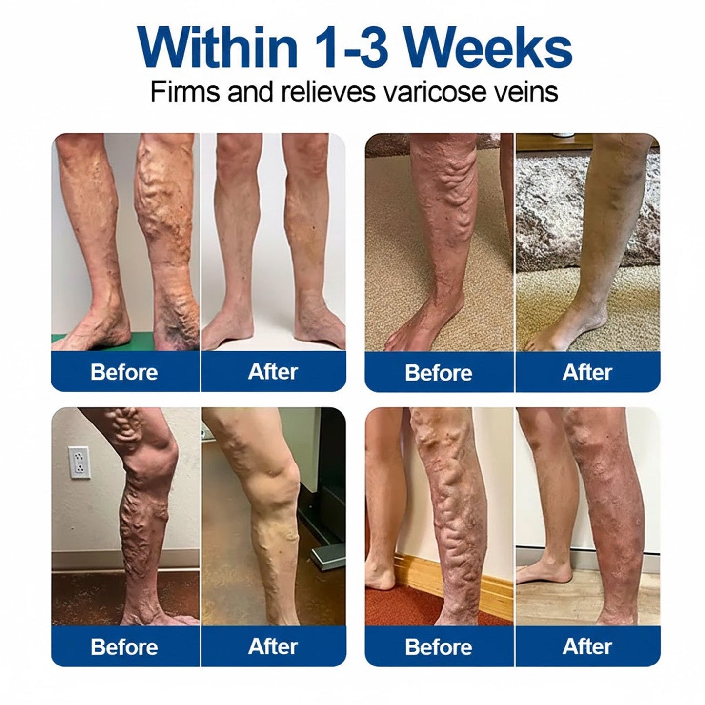 🇺🇸👨‍⚕️✅ JUXEK® Vein Ease Microneedle Patch — Visible Vein Reduction in 7 Days, No Clinic, No Compression Socks, Just Sleep ⚡