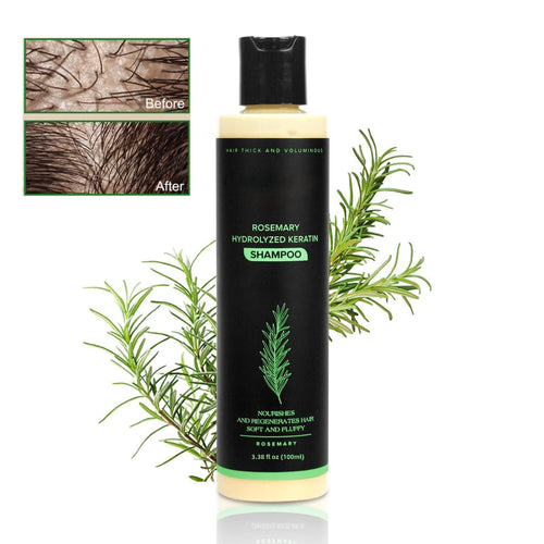 🔖Buy 2 Get 1 Free🧴Newly upgraded Rosemary Hair Growth Shampoo - suitable for all types of hair loss