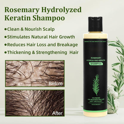 🔖Buy 2 Get 1 Free🧴Newly upgraded Rosemary Hair Growth Shampoo - suitable for all types of hair loss