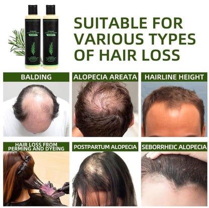 🔖Buy 2 Get 1 Free🧴Newly upgraded Rosemary Hair Growth Shampoo - suitable for all types of hair loss