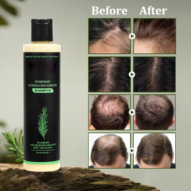 🔖Buy 2 Get 1 Free🧴Newly upgraded Rosemary Hair Growth Shampoo - suitable for all types of hair loss