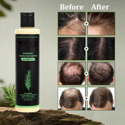 🔖Buy 2 Get 1 Free🧴Newly upgraded Rosemary Hair Growth Shampoo - suitable for all types of hair loss